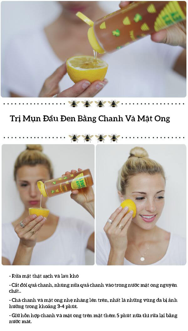 1.001 tuyệt chiêu trị mụn đầu đen hiệu quả 43 1.001 tuyệt chiêu trị mụn đầu đen hiệu quả 15