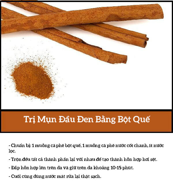 1.001 tuyệt chiêu trị mụn đầu đen hiệu quả 45 1.001 tuyệt chiêu trị mụn đầu đen hiệu quả 17