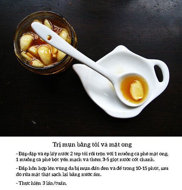 1.001 tuyệt chiêu trị mụn đầu đen hiệu quả 49 1.001 tuyệt chiêu trị mụn đầu đen hiệu quả 21