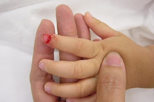 14 triệu chứng nguy hiểm ở trẻ cha mẹ không nên xem nhẹ 11