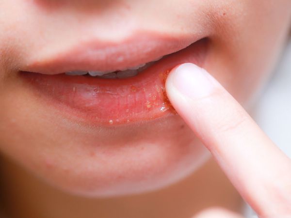 3 loại mặt nạ cực tốt cho đôi môi trong mùa đông 40