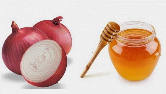 8 công thức cho mái tóc chắc khỏe từ hành tây 34 8 công thức cho mái tóc chắc khỏe từ hành tây 6