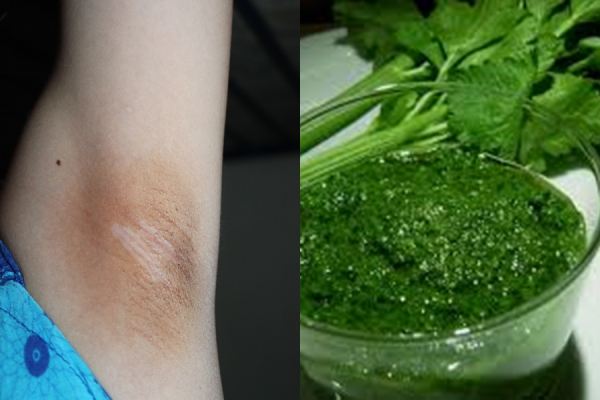 Bật mí mẹo đánh bật mùi hôi nách khó chịu chỉ với vài bước đơn giản 33 Bật mí mẹo đánh bật mùi hôi nách khó chịu chỉ với vài bước đơn giản 5