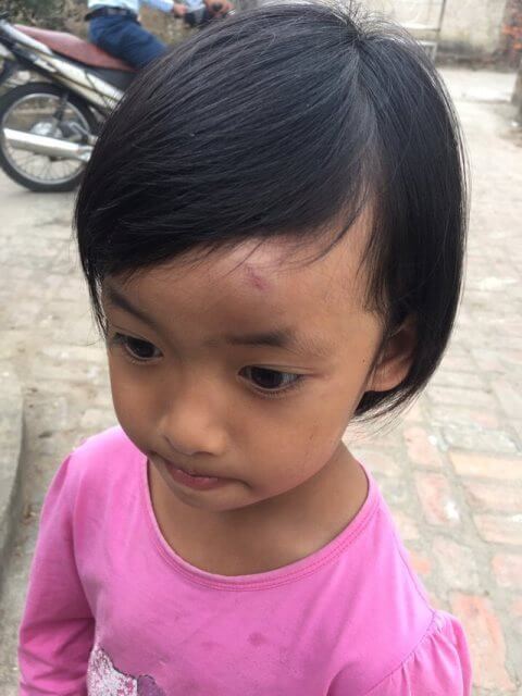 Bé 4 tuổi bị cô giáo ném dép vào trán vì... nói chuyện trong lớp 33 Bé 4 tuổi bị cô giáo ném dép vào trán vì... nói chuyện trong lớp 5