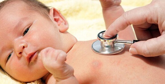 Bệnh cúm ở trẻ sơ sinh những điều mẹ nên biết 35 điều trị cúm