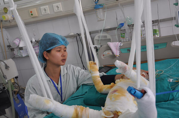 Bị chảo mỡ nóng đổ vào người, bé 2 tuổi bỏng 75% cơ thể 42 Bị chảo mỡ nóng đổ vào người, bé 2 tuổi bỏng 75% cơ thể 14