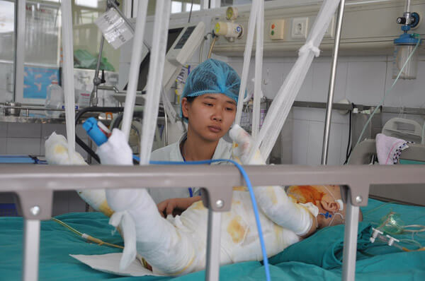 Bị chảo mỡ nóng đổ vào người, bé 2 tuổi bỏng 75% cơ thể 44 Bị chảo mỡ nóng đổ vào người, bé 2 tuổi bỏng 75% cơ thể 16