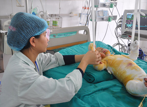 Bị chảo mỡ nóng đổ vào người, bé 2 tuổi bỏng 75% cơ thể 46 Bị chảo mỡ nóng đổ vào người, bé 2 tuổi bỏng 75% cơ thể 18