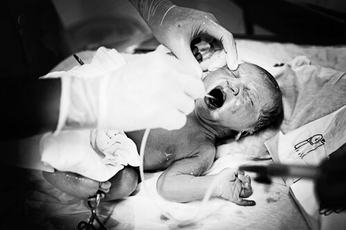 Bộ ảnh ông bố bác sỹ tự tay đỡ đẻ cho vợ gây xúc động 52 ông bố bác sỹ tự tay đỡ đẻ cho vợ 4