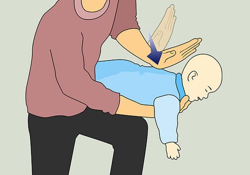 Các bước sơ cứu nhanh khi trẻ bị nghẹn, đuối nước và chó cắn 37 bi-nghen