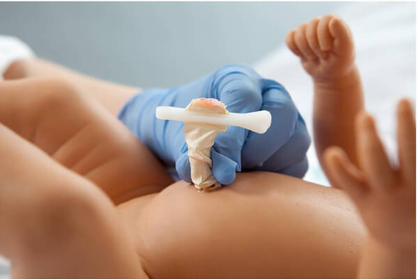 Các bước vệ sinh và chăm sóc dây rốn bé yêu đúng cách 6