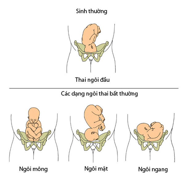 Các kiểu ngôi thai mẹ bầu nào cũng nên biết 35 ngoi-thia