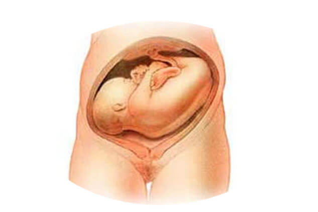 Các kiểu ngôi thai mẹ bầu nào cũng nên biết 37 ngoi-ngang