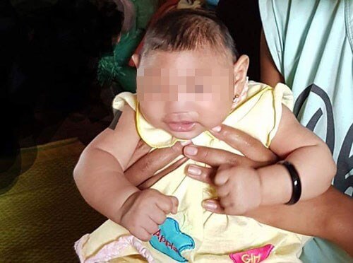 Cách ngăn ngừa vi rút Zika lan truyền trong cộng đồng 34 Cách ngăn ngừa vi rút Zika lan truyền trong cộng đồng 6