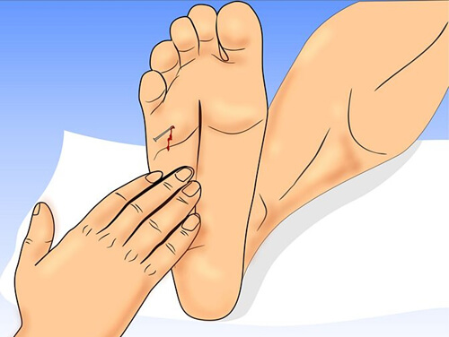 Cách xử lý thông minh khi con bị vật nhọn đâm vào người 35 Cách xử lý thông minh khi con bị vật nhọn đâm vào người 7