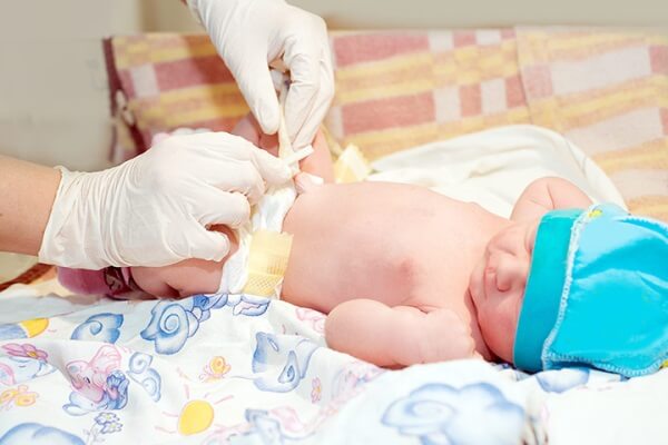 Chăm sóc rốn cho bé sơ sinh đúng cách 8