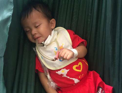Cháu bé uống nhầm a xít gần 1 năm không ăn được cơm 33 Cháu bé uống nhầm a xít gần 1 năm không ăn được cơm 5
