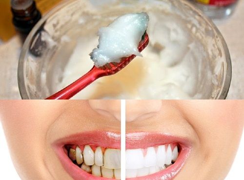 Chỉ cần dùng hỗn hợp này trong 1 tuần sẽ có hàm răng trắng sáng và hơi thở thơm tho 35 Chỉ cần dùng hỗn hợp này trong 1 tuần sẽ có hàm răng trắng sáng và hơi thở thơm tho 7