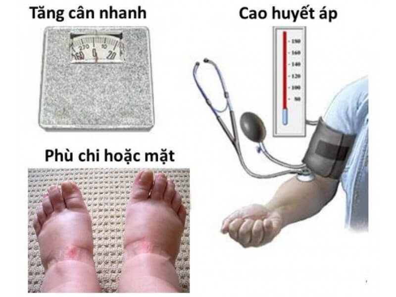 Chị em nên biết 4 tai biến sản khoa thường gặp này 36 Chị em nên biết 4 tai biến sản khoa thường gặp này 9