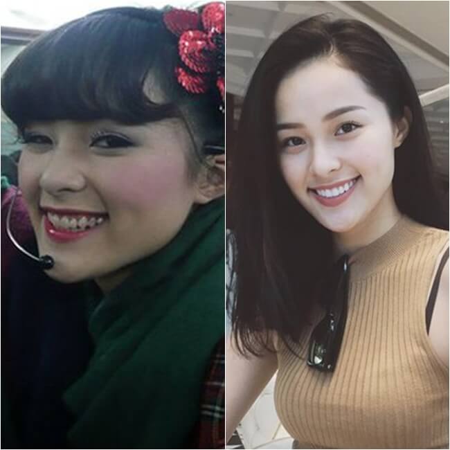 Choáng với hình ảnh mỹ nhân Việt trước khi "lên đời" nhờ... răng 30