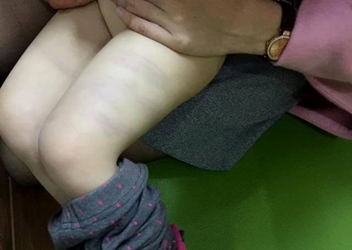 Đánh trẻ cho thấy thầy cô không có năng lực, phẩm chất và đạo đức 34 Đánh trẻ cho thấy thầy cô không có năng lực, phẩm chất và đạo đức 6