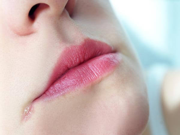 Đôi môi và những dấu hiệu cảnh báo sức khỏe 39 Đôi môi và những dấu hiệu cảnh báo sức khỏe 11