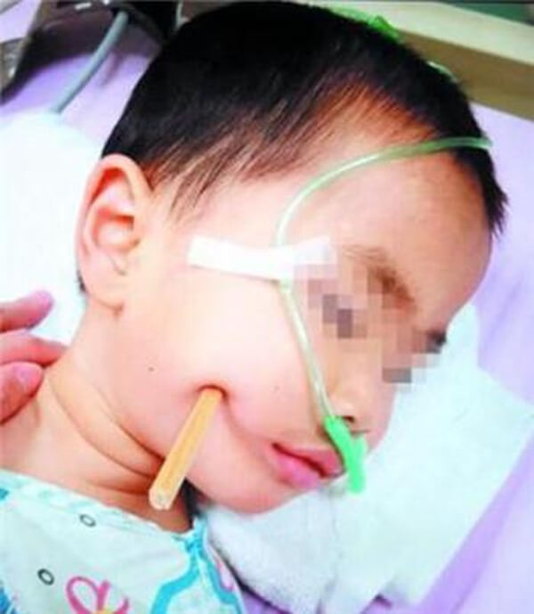Đũa ăn cơm, hung thần của trẻ nhỏ 44 Đũa ăn cơm, hung thần của trẻ nhỏ 16