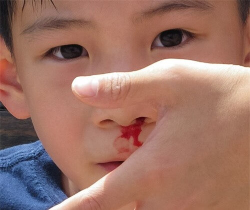 Đừng lơ là dấu hiệu sớm cảnh báo ung thư ở trẻ nhỏ 7