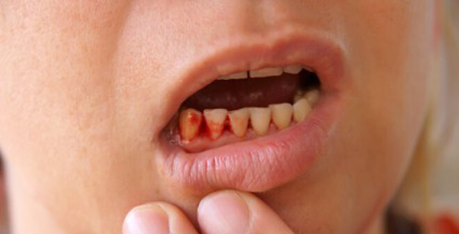 Đừng lơ là với những vết bầm tím trên người con trẻ 8