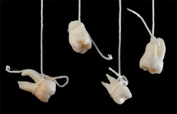Giải mã ý nghĩa của những cơn ác mộng thường gặp 39 răng