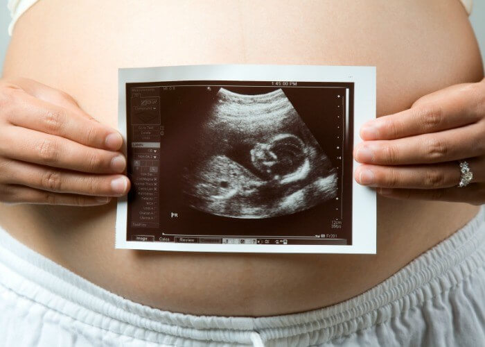 Gợi ý 16 cách chụp hình "tự sướng" siêu dễ thương với bụng bầu 29