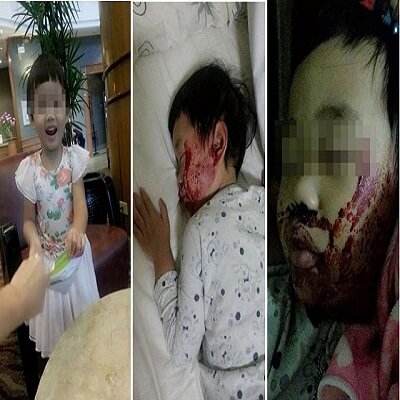 Hiểm họa khôn lường từ chiếc giường của bé 35 Hiểm họa khôn lường từ chiếc giường của bé 7
