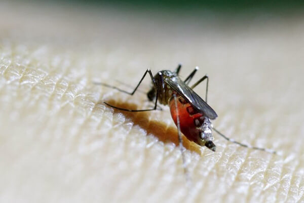 Mẹ bầu nếu bị nhiễm virus Zika con sinh ra sẽ teo não 36 Mẹ bầu nếu bị nhiễm virus Zika con sinh ra sẽ teo não 8