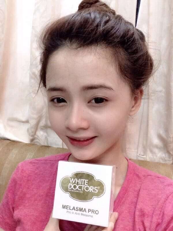 Mẹo trị hết sạch nám da, tàn nhang sau 3 tuần 66 Mẹo trị hết sạch nám da, tàn nhang sau 3 tuần 32