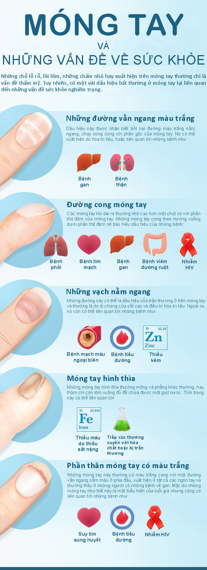 Móng tay cảnh báo 12 bệnh nguy hiểm, bạn cần đề phòng 33 móng tay