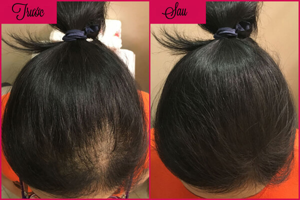 Một số mẹo vặt làm đẹp tiện ích mà ai cũng phải biết 41 Một số mẹo vặt làm đẹp tiện ích mà ai cũng phải biết 13