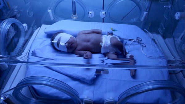 Mỹ: Bé gái nguy kịch vì nhiễm virut herpes của người tới thăm 33 Mỹ: Bé gái nguy kịch vì nhiễm virut herpes của người tới thăm 5