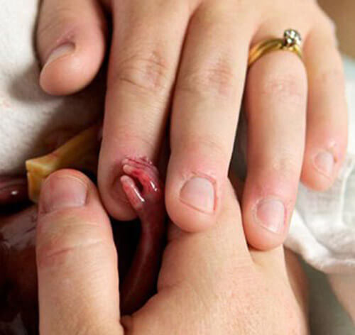 Nếu bạn có ý định phá thai, hãy đọc bài viết này trước đã 12