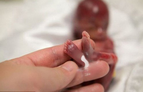 Nếu bạn có ý định phá thai, hãy đọc bài viết này trước đã 18