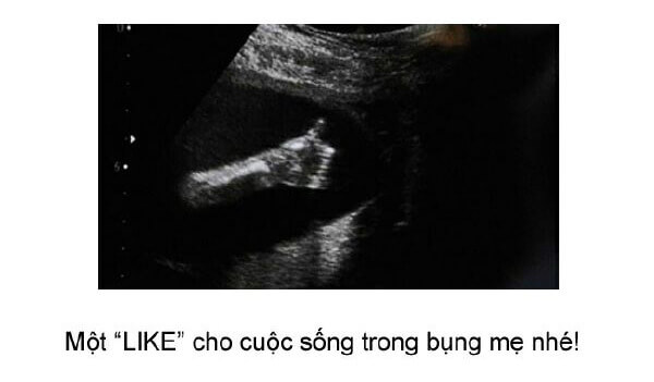 Ngắm loạt ảnh thai nhi tạo dáng đáng yêu không thể tả 45 Ngắm loạt ảnh thai nhi tạo dáng đáng yêu không thể tả 17