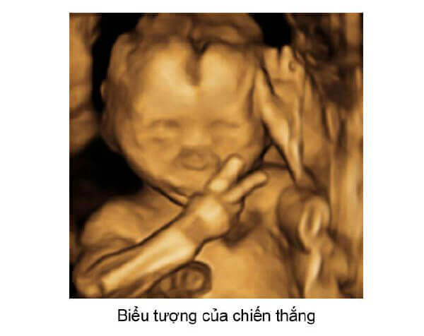 Ngắm loạt ảnh thai nhi tạo dáng đáng yêu không thể tả 46 Ngắm loạt ảnh thai nhi tạo dáng đáng yêu không thể tả 18