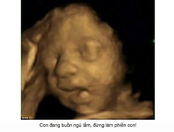 Ngắm loạt ảnh thai nhi tạo dáng đáng yêu không thể tả 55 Ngắm loạt ảnh thai nhi tạo dáng đáng yêu không thể tả 27