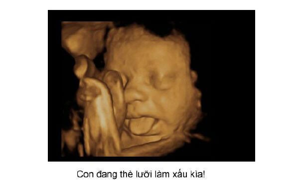 Ngắm loạt ảnh thai nhi tạo dáng đáng yêu không thể tả 47 Ngắm loạt ảnh thai nhi tạo dáng đáng yêu không thể tả 19