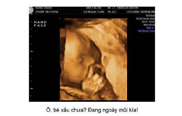 Ngắm loạt ảnh thai nhi tạo dáng đáng yêu không thể tả 49 Ngắm loạt ảnh thai nhi tạo dáng đáng yêu không thể tả 21