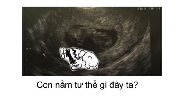 Ngắm loạt ảnh thai nhi tạo dáng đáng yêu không thể tả 51 Ngắm loạt ảnh thai nhi tạo dáng đáng yêu không thể tả 23