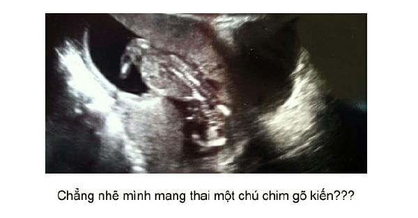 Ngắm loạt ảnh thai nhi tạo dáng đáng yêu không thể tả 52 Ngắm loạt ảnh thai nhi tạo dáng đáng yêu không thể tả 24