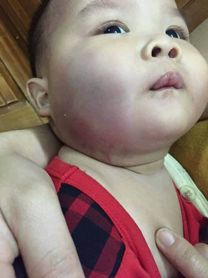 Nghi ngờ bé 8 tháng tuổi bạo hành ở trường mầm non 7
