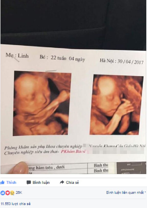 Nhờ các bạn mà vợ chồng tôi ly hôn đầy nước mắt 36 Nhờ các bạn mà vợ chồng tôi ly hôn đầy nước mắt 8