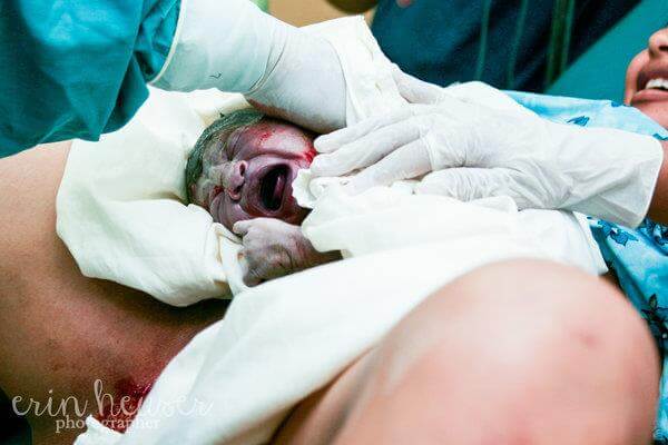 Những bức ảnh tuyệt đẹp ghi lại khoảnh khắc lâm bồn ở khắp nơi trên thế giới 63 sinh-con
