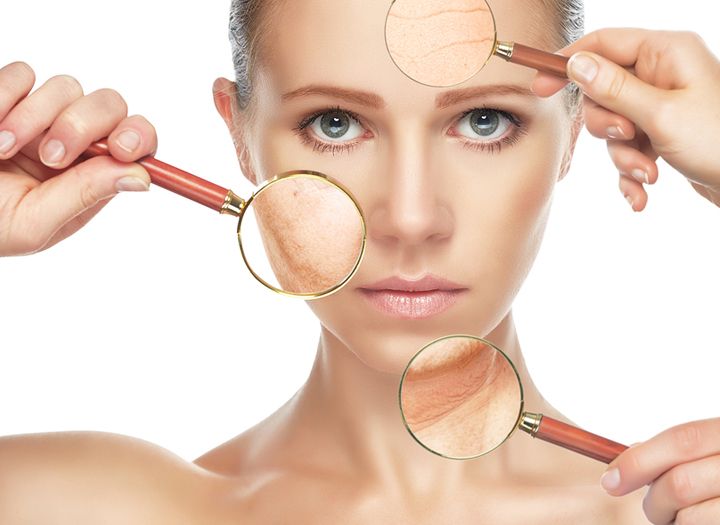 Những dấu hiệu giúp bạn nhận biết cơ thể đang thiếu hụt collagen 35 da-thieu-suc-song